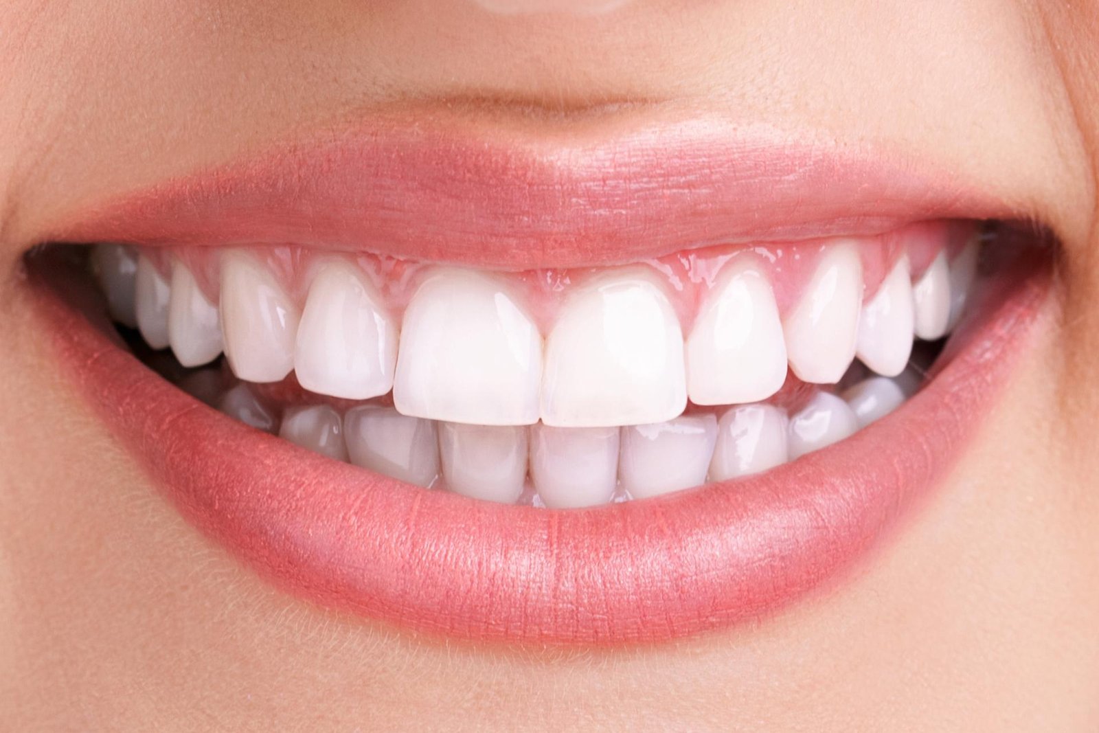 Before teeth whitening treatment