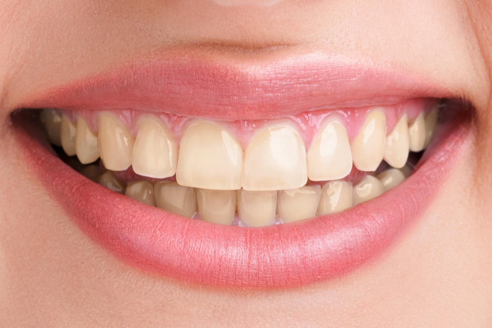 After teeth whitening treatment