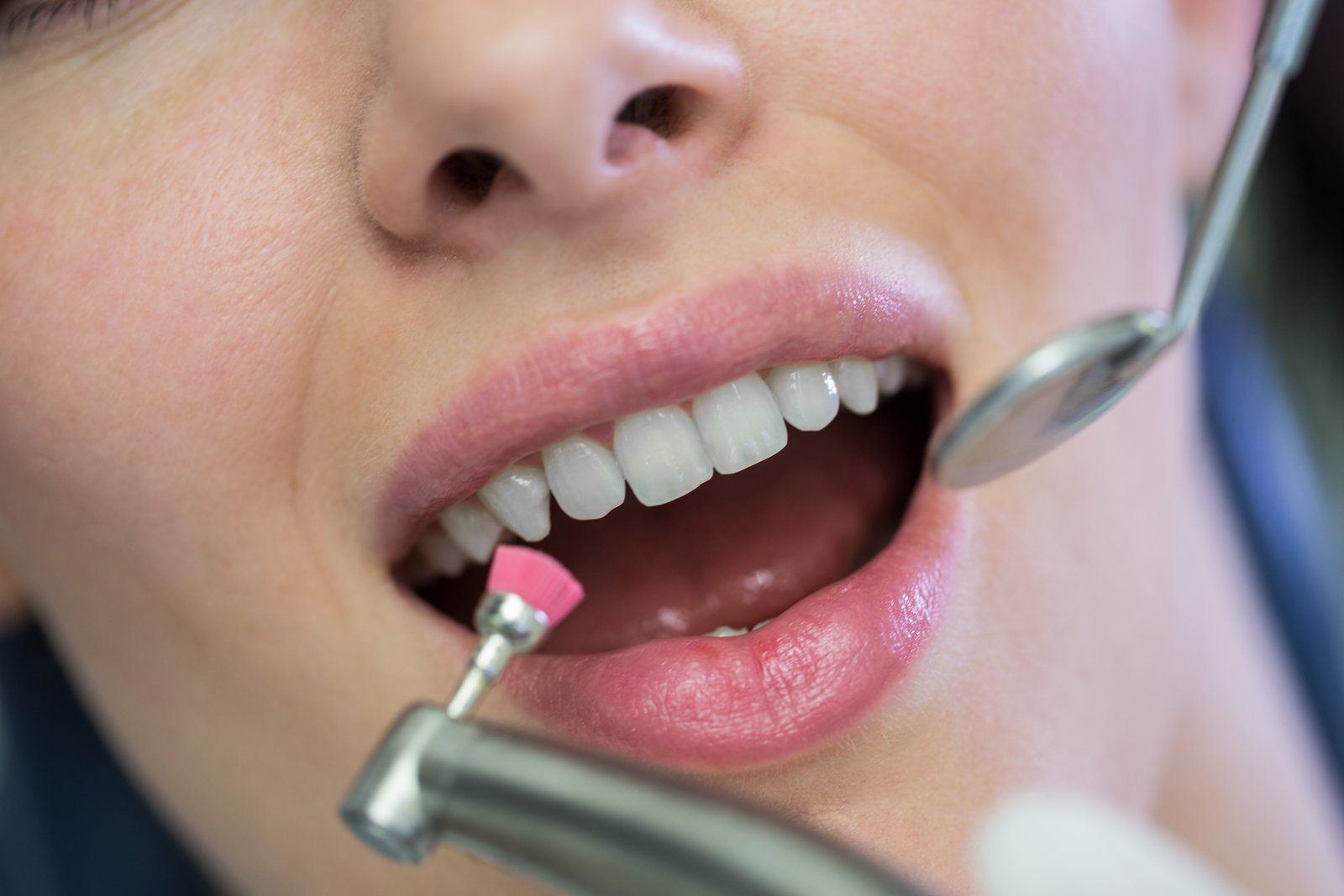 Dental Cleaning Procedure