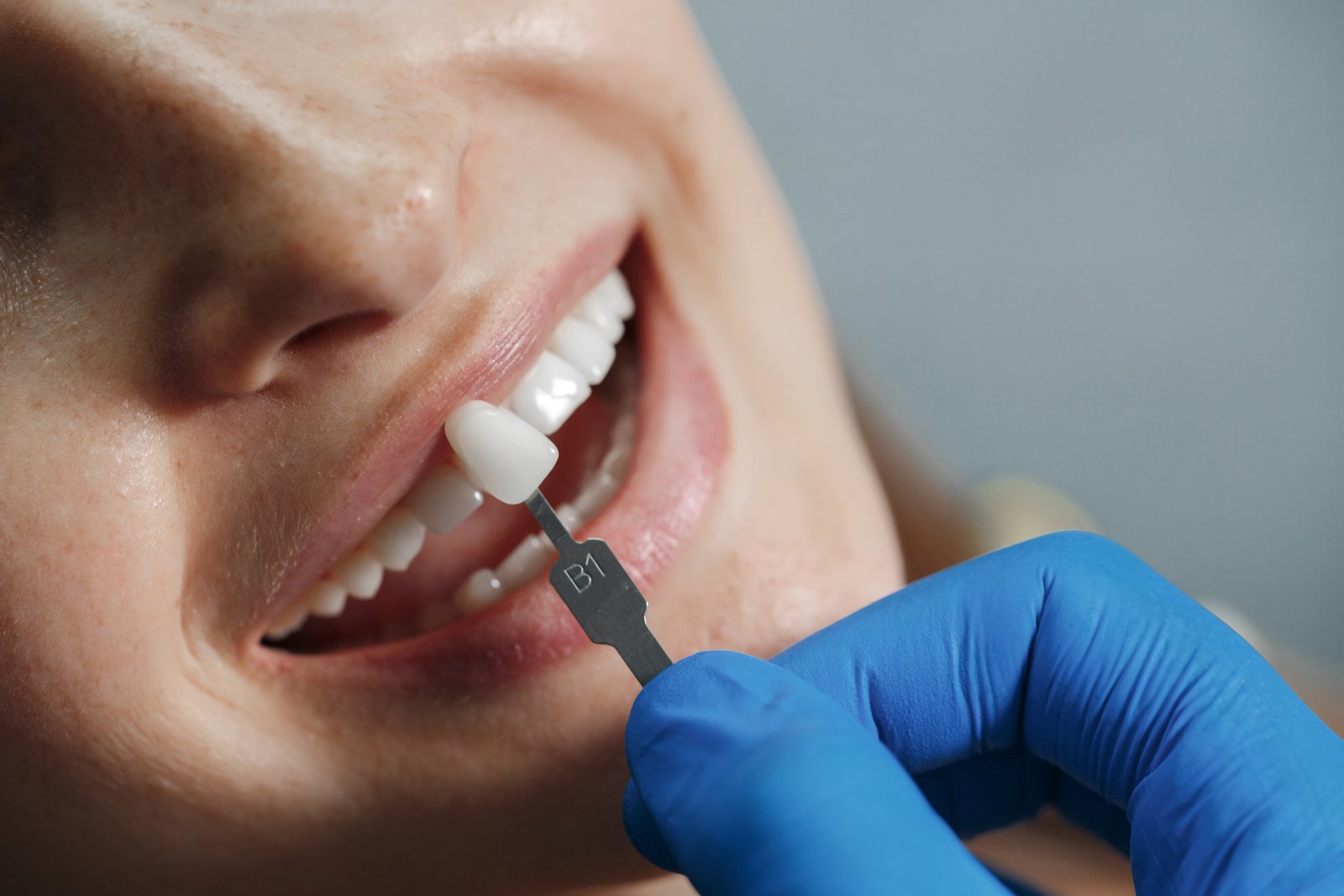 Laser Dentistry